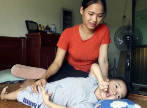 Bại não thể co cứng có chữa được không? {Sự thật từ chuyên gia}